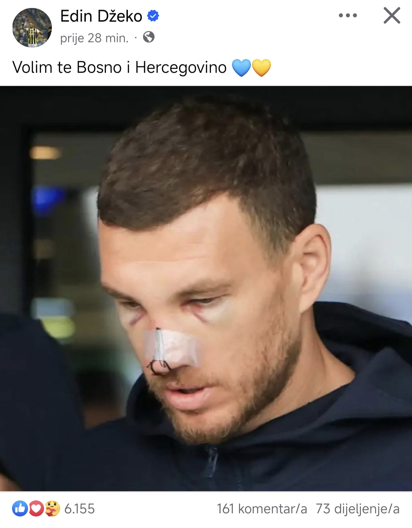 Edin Džeko Status